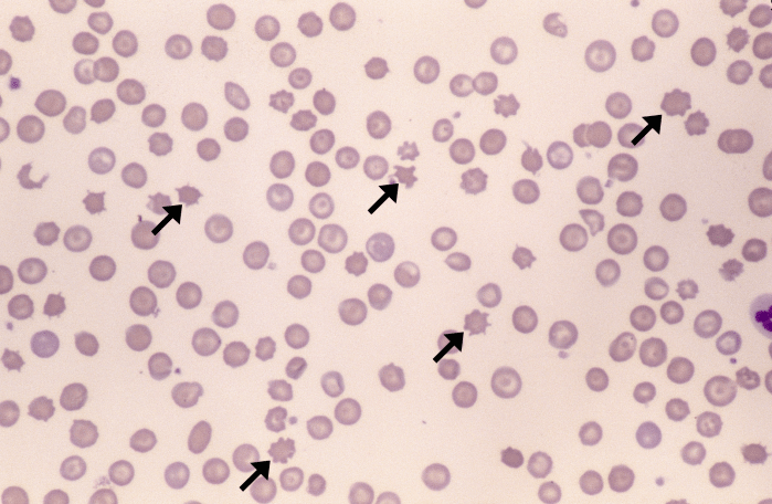 Acanthocytes 2 (Canine - HSA2) ARROWS