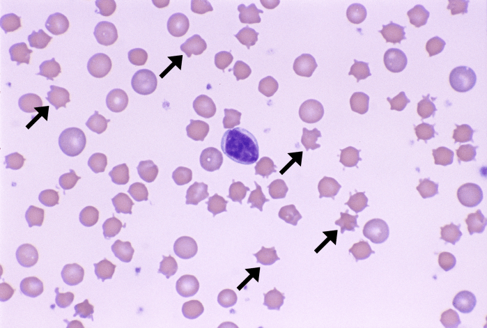 Acanthocytes 5 (Rabbit) ARROWS