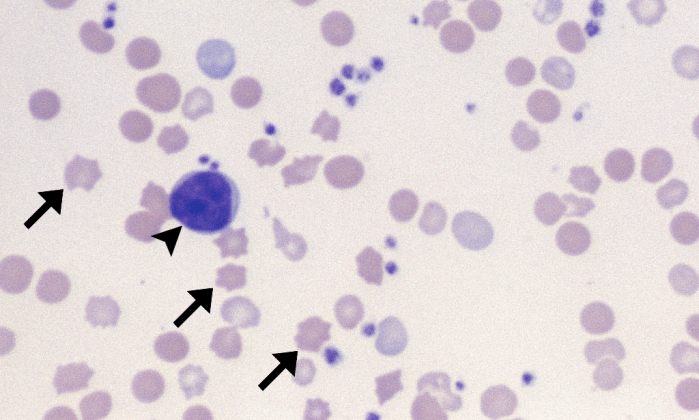 Acanthocytes 7 (Canine 4 - Iron Deficiency) ARROWS
