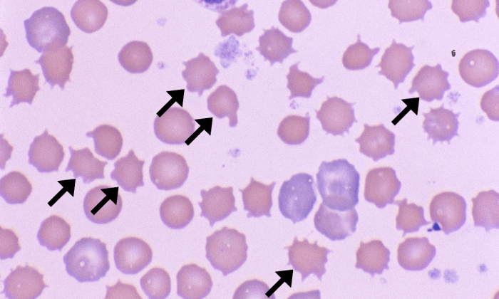 Acanthocytes 8 (Rabbit 1 - High Cholesterol Diet) ARROWS