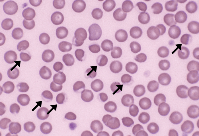 Eccentrocytes 1 (Canine - Onion Tox) ARROWS