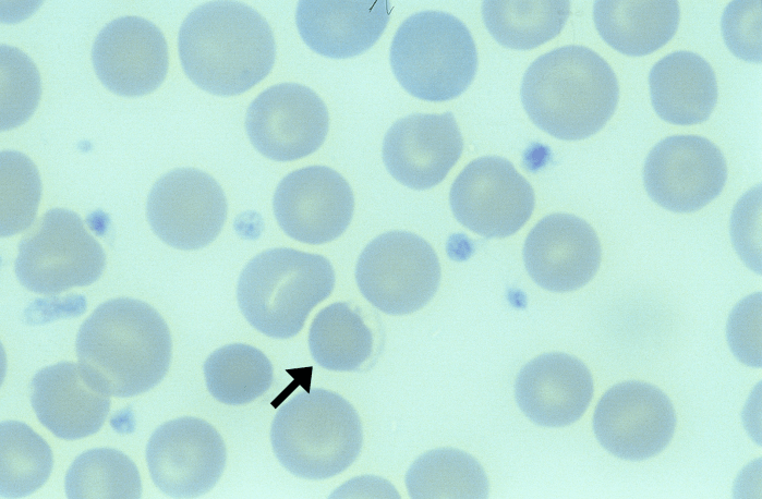 Eccentrocytes 2 (Canine) ARROWS