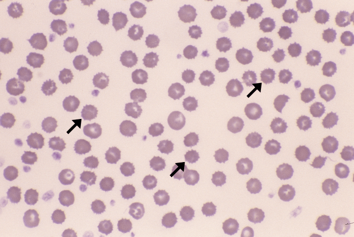 Echinocytosis (Canine - EDTA Artifact) ARROWS