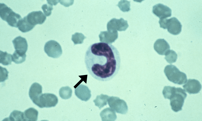 Bands 1 (Canine 1) ARROWS