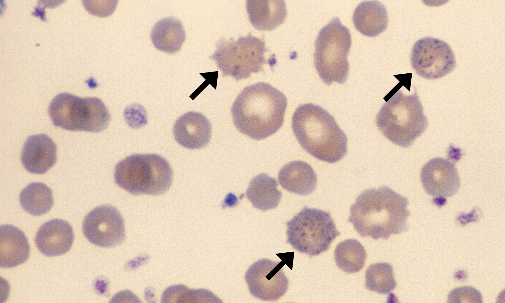 Basophilic Stippling 2 (Bovine 2) ARROWS