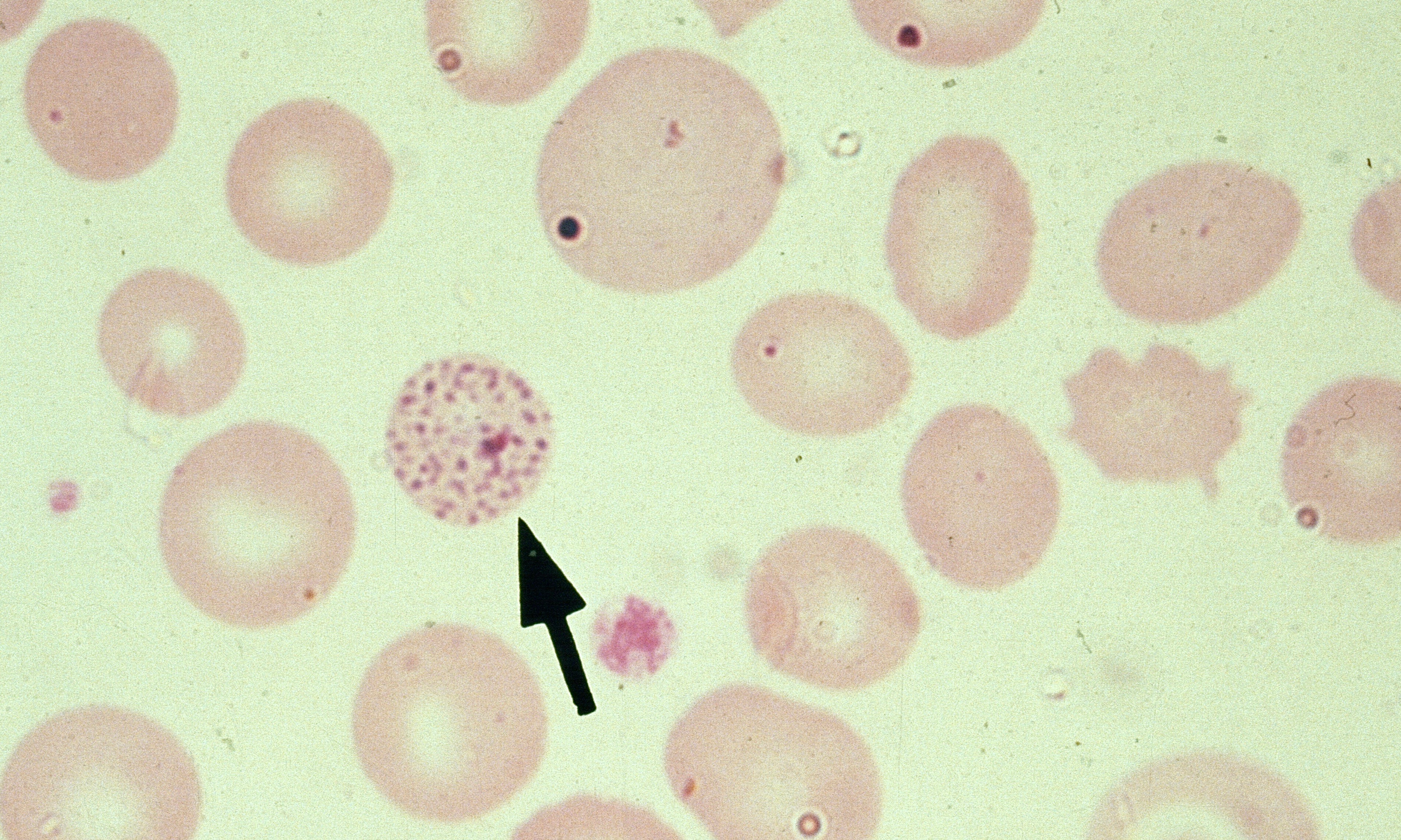 Basophilic Stippling 3 (Bovine 3) ARROW INCLUDED