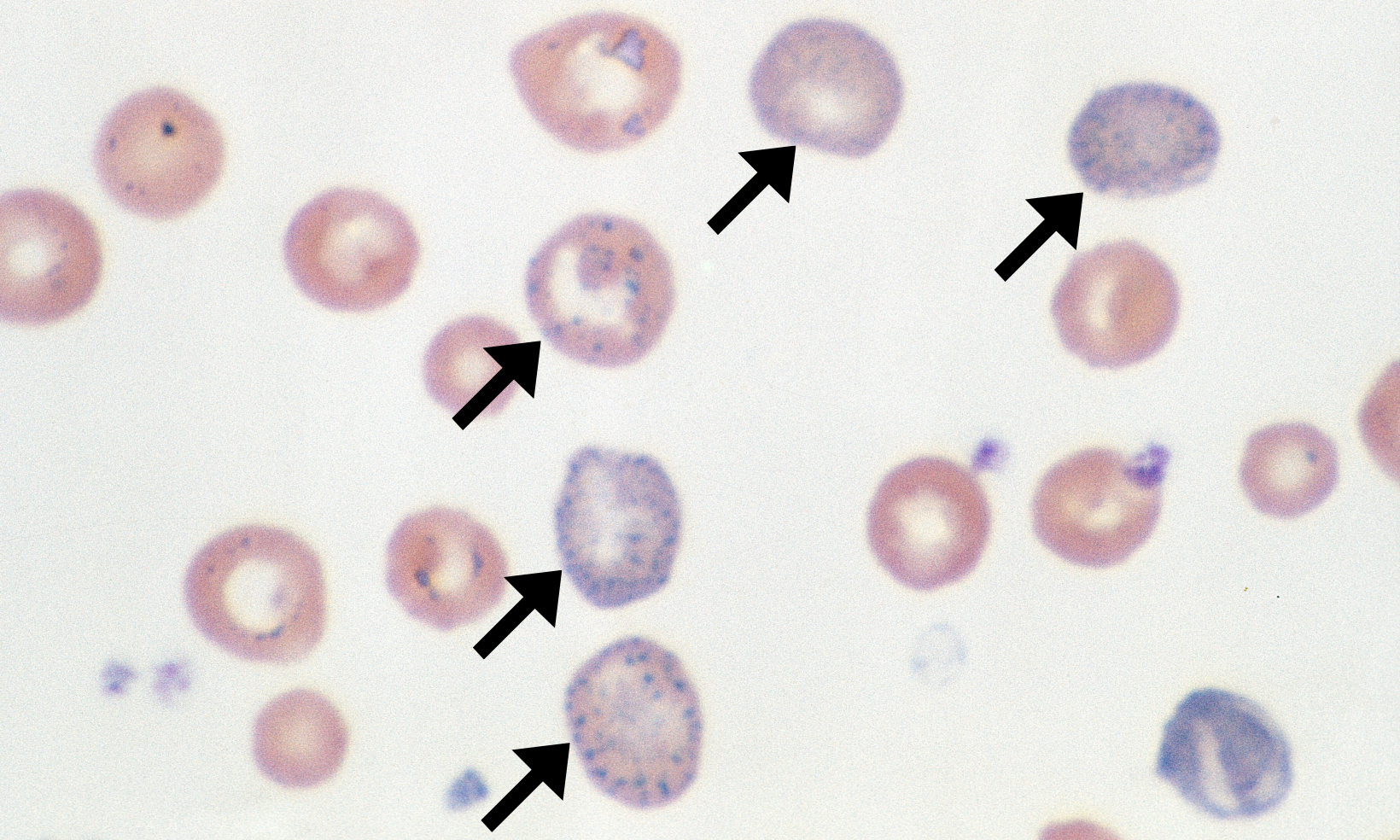 Basophilic Stippling 4 (Bovine 4 - Regen Anemia) ARROWS