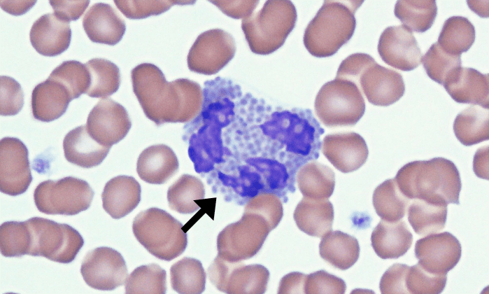 Basophils 3 (Feline 1) ARROWS