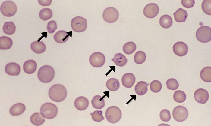 Cytauxzoon felis 1 ARROWS