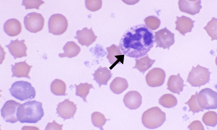Eosinophils 10 (Rabbit 1) ARROWS