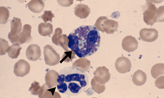 Eosinophils 2 (Canine 2) ARROWS