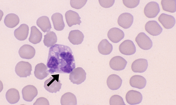 Eosinophils 3 (Canine 3) ARROWS
