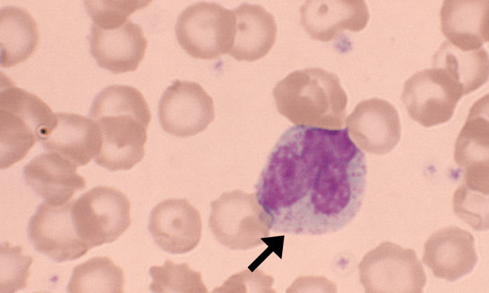 Eosinophils 4 (Canine 4) ARROWS