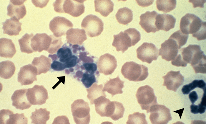 Eosinophils 5 (Canine 5) ARROWS