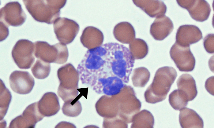 Eospinophils 11 (Feline 1) ARROWS