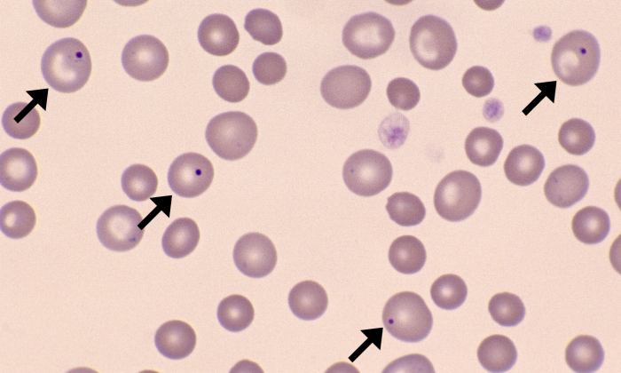 Howell-Jolly Bodies 1 (Canine 1) ARROWS