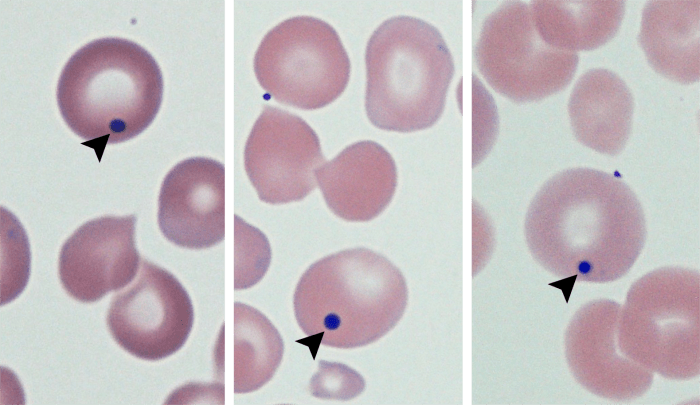 Howell-Jolly Bodies 3-5 (Canine 2-4) ARROWS