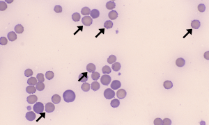 Cat Rbc Under Microscope Mycoplasma – Cells and Smears