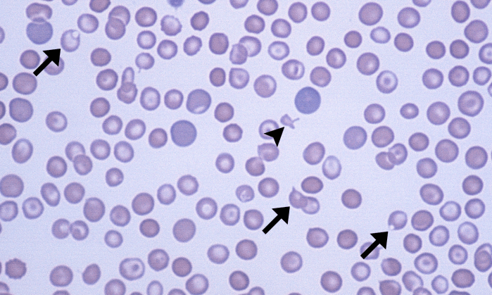 Keratocytes 4 (Canine 4 - DIC) ARROWS