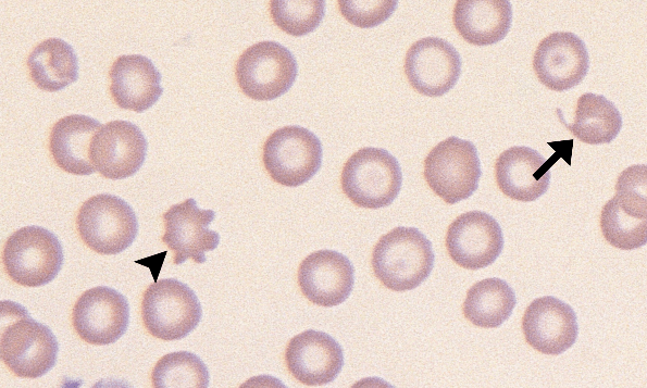 Keratocytes 6 (Canine 3 - Iron Deficiency) ARROWS