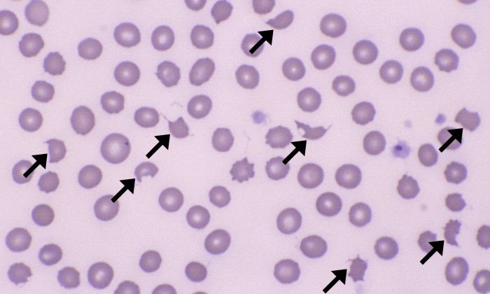 Schizocytes 4 (Canine 4 - Microangiopathy) ARROWS