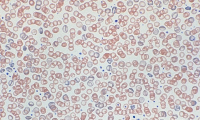 Hypochromasia 6 (Canine 6)