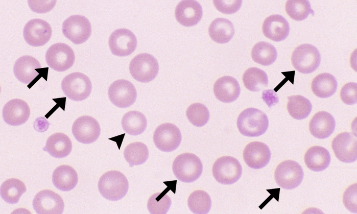 Macrocytes 2 (Canine 2 - Macrocytic Normochromic Anemia) ARROWS