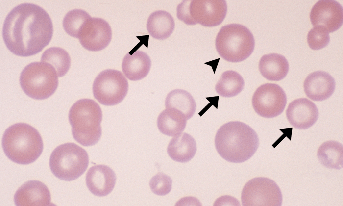 Microcytes 1 (Canine 1 - Iron Deficiency) ARROWS