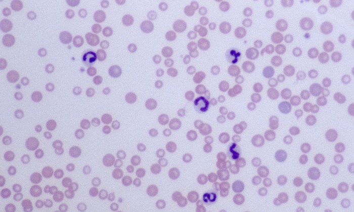 Microcytes 4 (Canine 4 - Iron Deficiency)