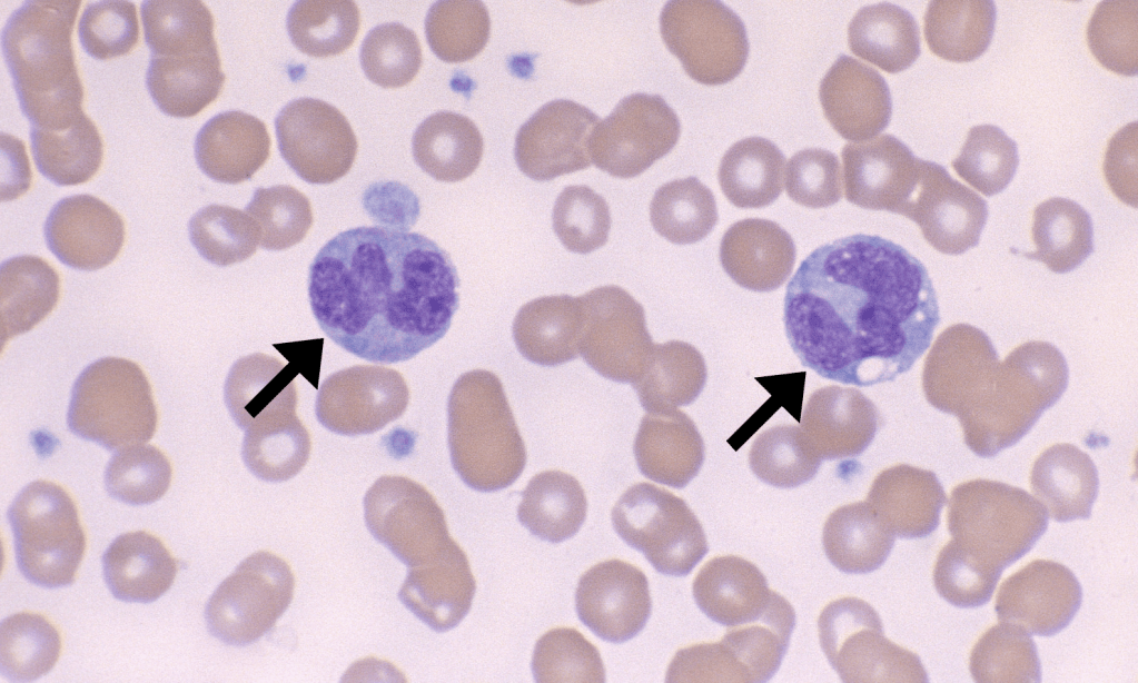 Monocytes – Cells and Smears