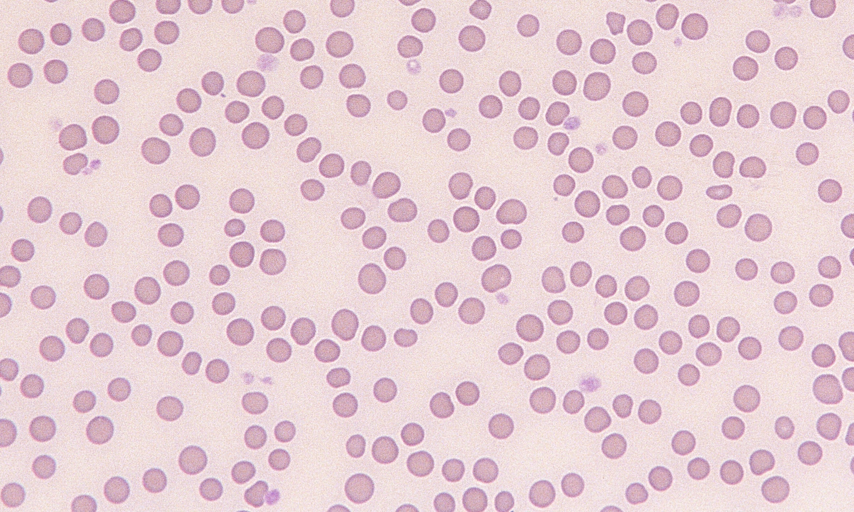 Normal Bovine Erythrocytes – Cells and Smears