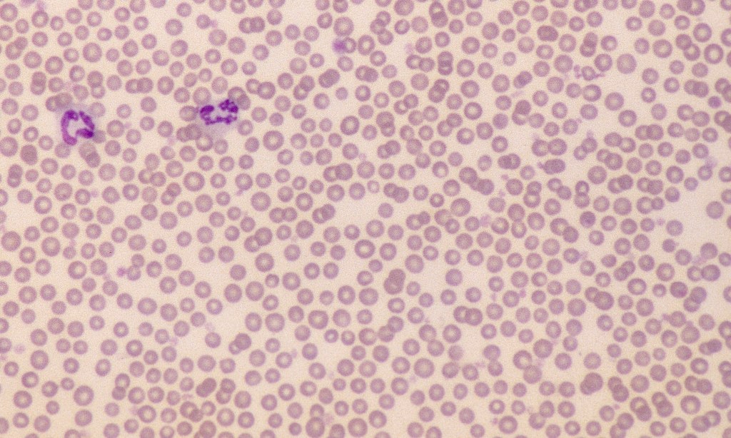 Normal Bovine Erythrocytes – Cells and Smears