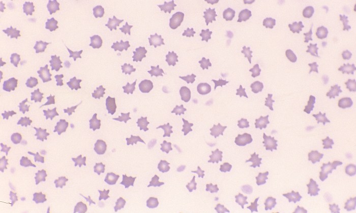 Normal Bovine 4 (Calf - Poikilocytosis)