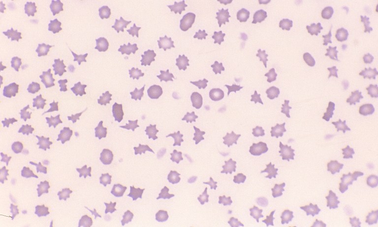 Normal Bovine Erythrocytes – Cells and Smears