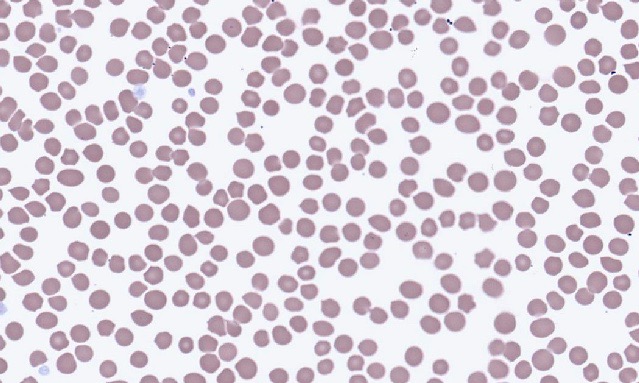 Normal Equine Erythrocytes – Cells and Smears