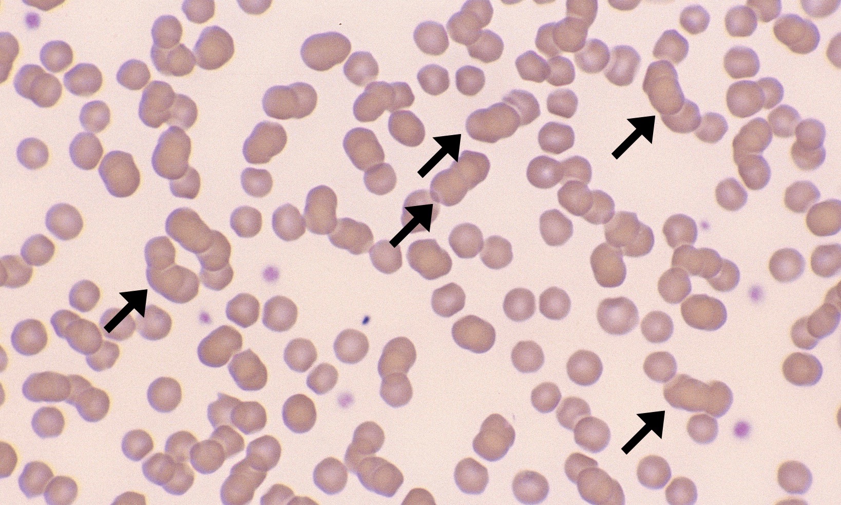 Normal Feline Rbc Normal Feline Erythrocytes – Cells and Smears