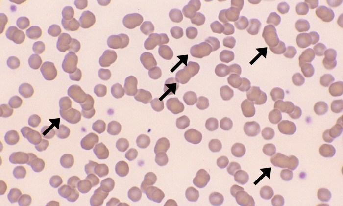 Normal Feline 3 (Rouleaux) ARROWS
