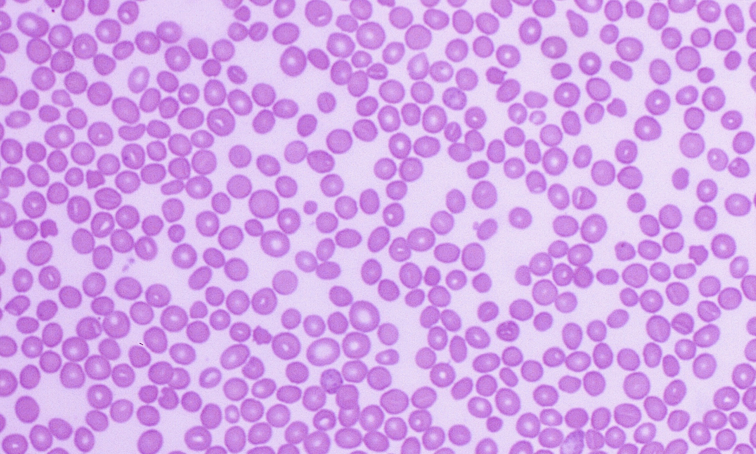 Normal – Cells and Smears