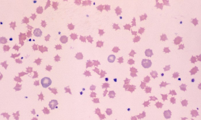 Normal Porcine 2 (Post-Hemorrhage)