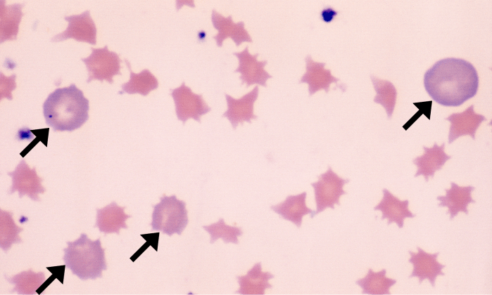 Normal Porcine 3 (Post-Hemorrhage) ARROWS
