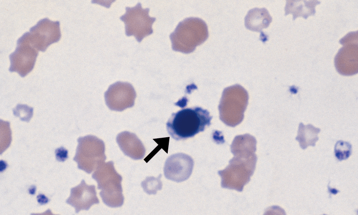 nRBC 5 (Porcine 1 - Metarubricyte, Iron Deficiency Anemia) ARROWS