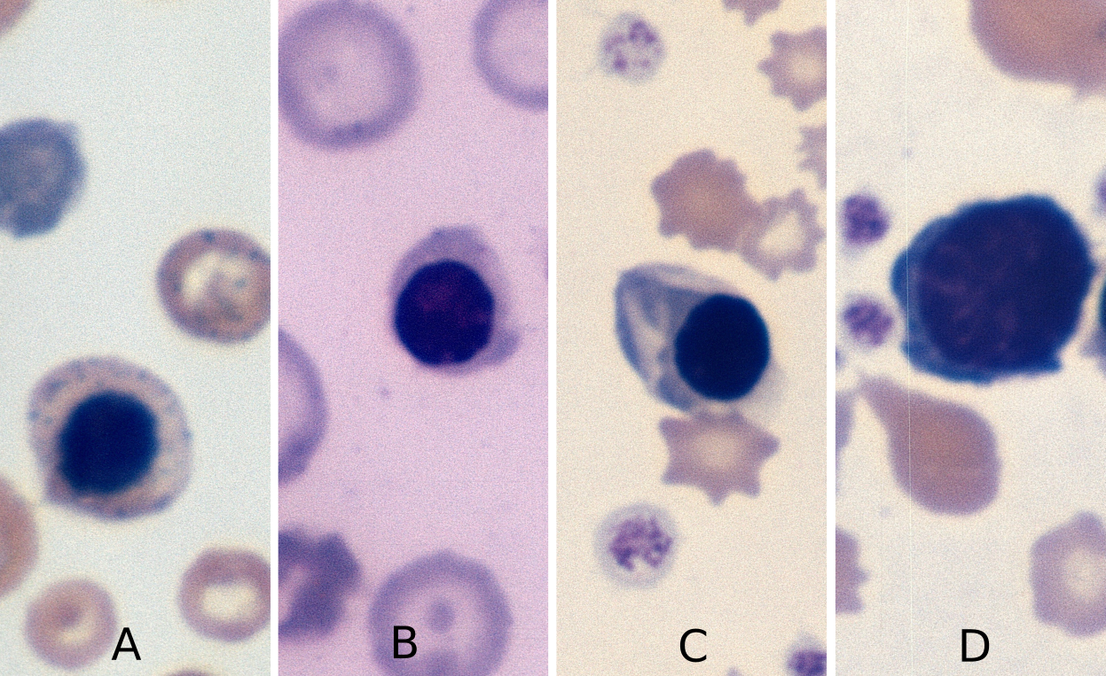 nRBC – Cells and Smears