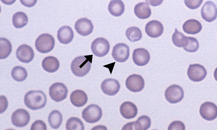 Torocyte Torocytes – Cells and Smears