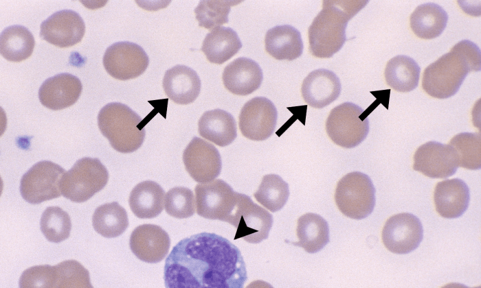 Torocytes 2 (Canine2) ARROWS