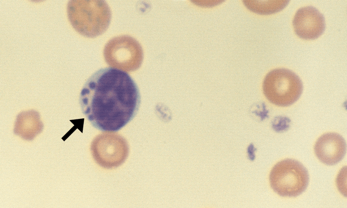 Gran Lymphocytes 4 (Bovine 4) ARROWS