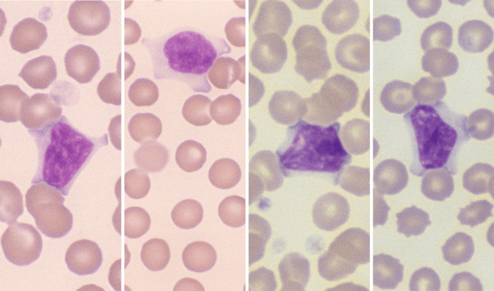 Lymphocytes 1-4 (Canine 1 -4) ARROWS