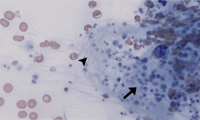 Platelet Clumps 3 (Canine 1) ARROWS