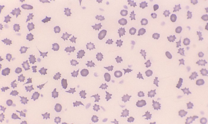 Poikilocytosis 1 (Bovine 1 - Calf)
