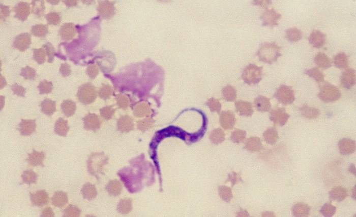 Trypanosomes 4 (Bovine 1)